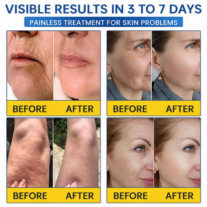 💠🔹🔷🇺🇸 HOT SALE Natravor® PDRN Anti-Wrinkle Shot – Lift & Firming Cream