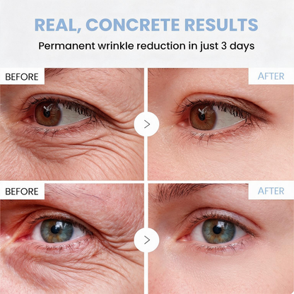 💠🔹🔷🇺🇸 HOT SALE Natravor® PDRN Anti-Wrinkle Shot – Lift & Firming Cream